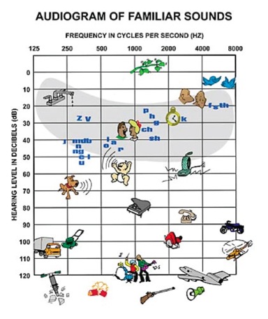 Hearing Level Chart